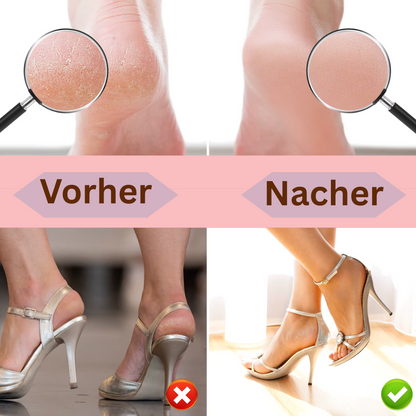 Wiederaufladbarer Hornhautentferner für die Füße